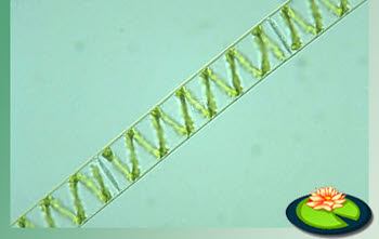 Draadalgen onder de microscoop
